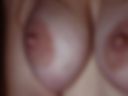 nipples
