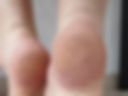 Dirty feet