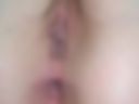 anal hole
