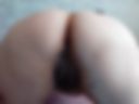 Cancer 2