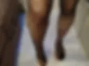 Legs