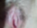 my body