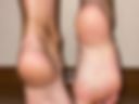 Legs