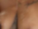 Desirable breasts