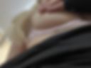 Breast