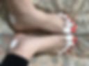 Legs