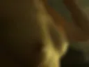 Breast