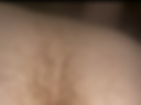 Anus