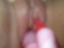 Masturbation