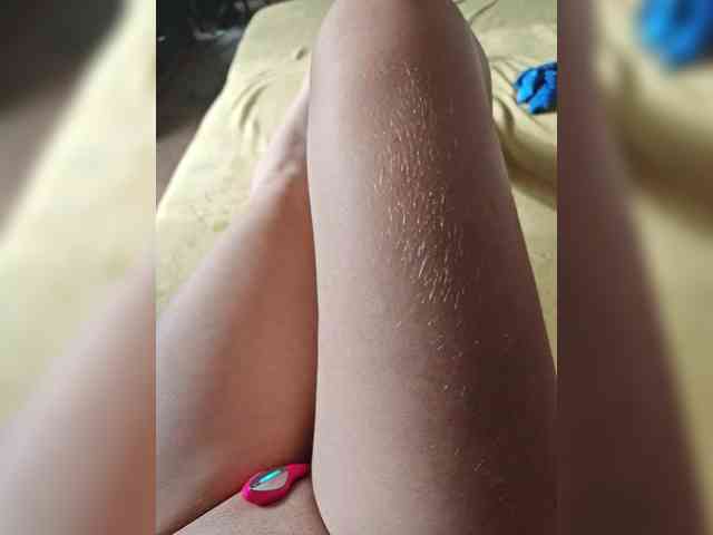Misslyolika
