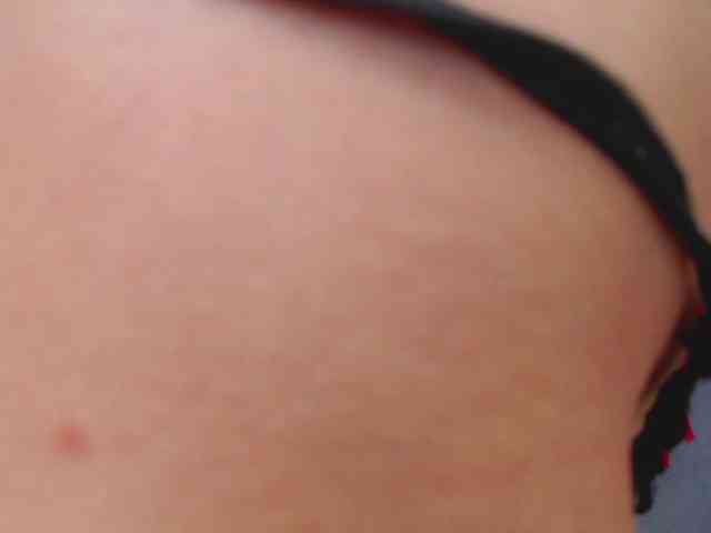 Missforkisss webcam
