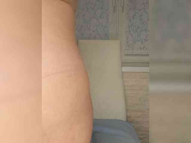 Anesteishen webcam