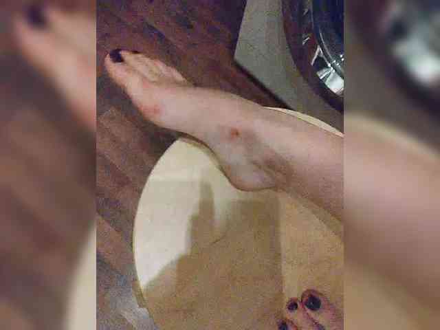 Non-stopa1