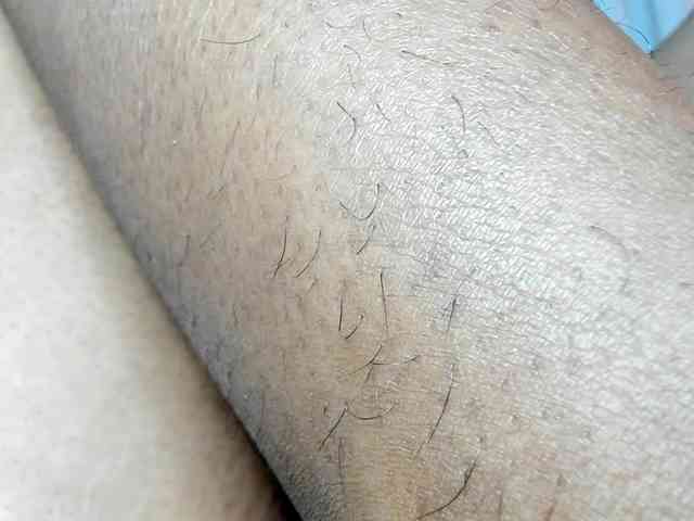 NATALIKIDMAN NATALIKIDMAN