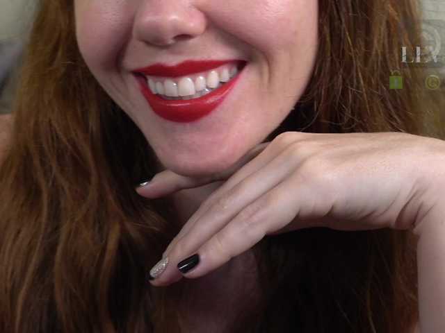 Preview of levurassets