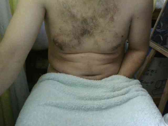 Deniera1