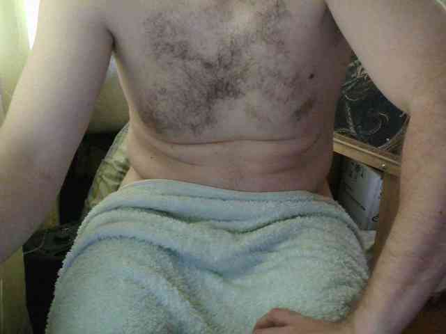 Deniera1