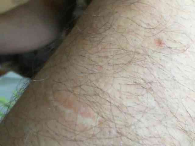 rebbit111a rebbit111a