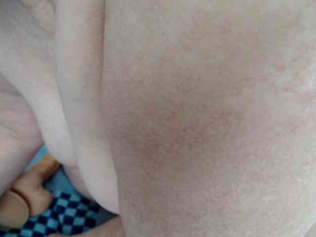 MILAax