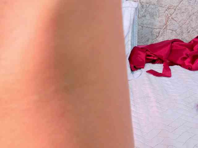 skinnyprinces webcam