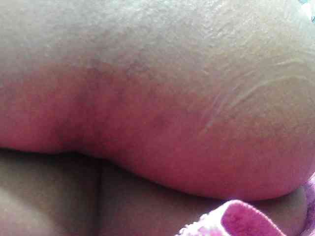 RACHELL-HOT RACHELL-HOT