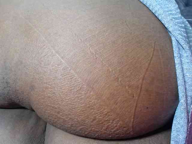 RACHELL-HOT RACHELL-HOT