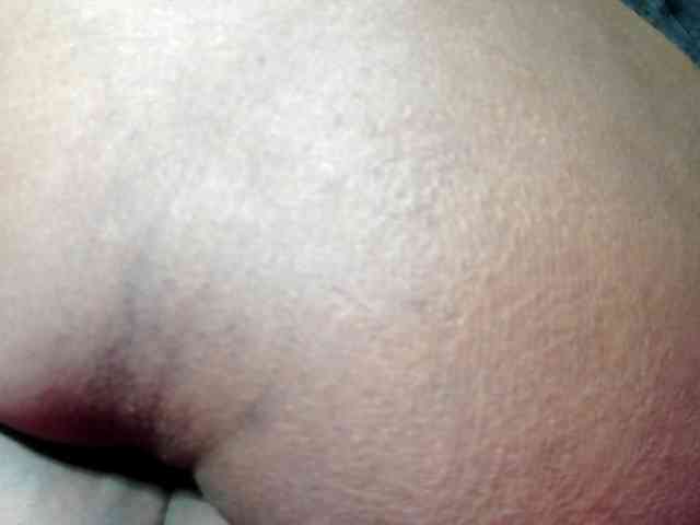 RACHELL-HOT RACHELL-HOT