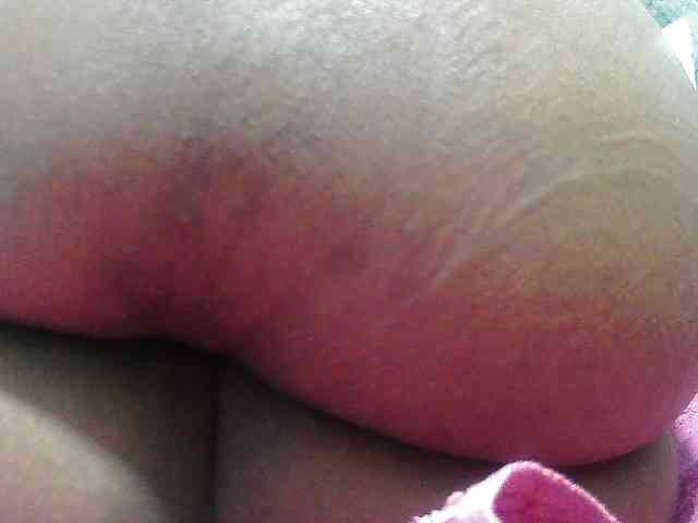 RACHELL-HOT RACHELL-HOT