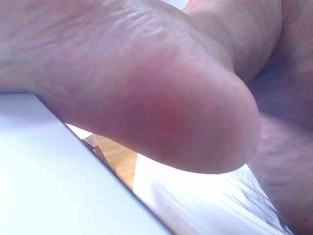 exotic-karmella exotic-karmella