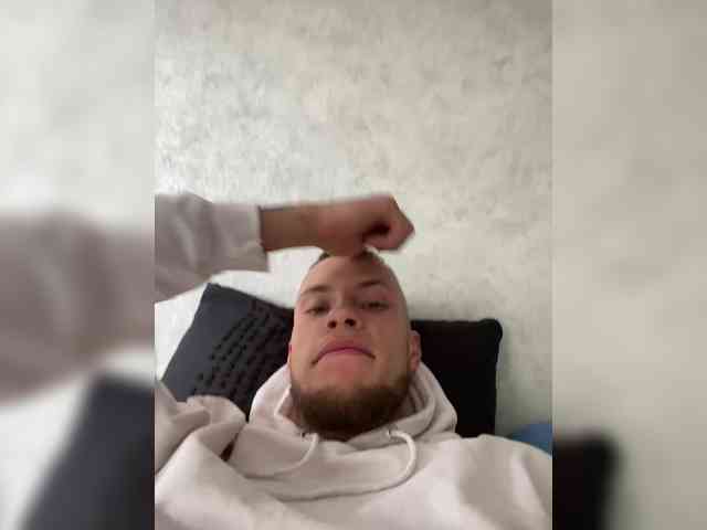 BALD1NO1