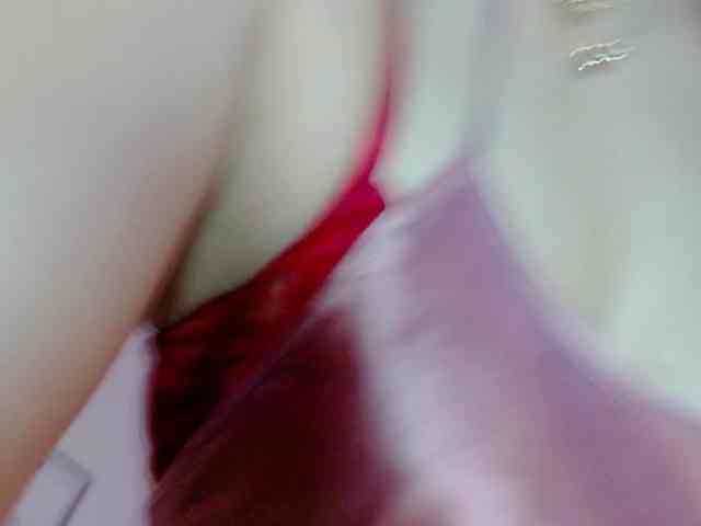 Ivypoison10 Ivypoison10