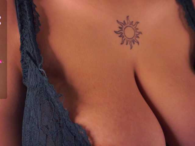 Preview of anuricbriny