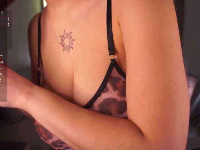 Preview of anuricbriny