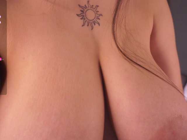 Preview of anuricbriny