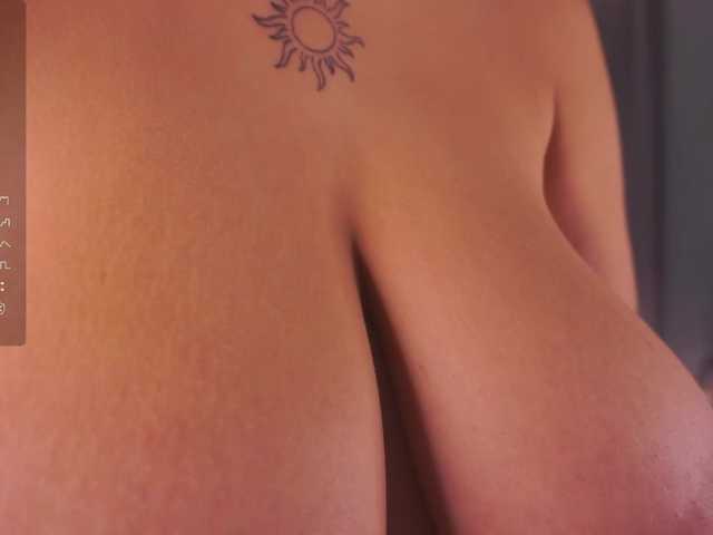 Preview of anuricbriny