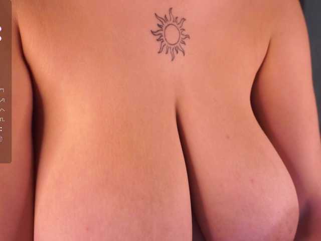 Preview of anuricbriny