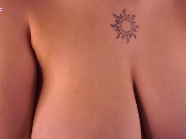 Preview of anuricbriny