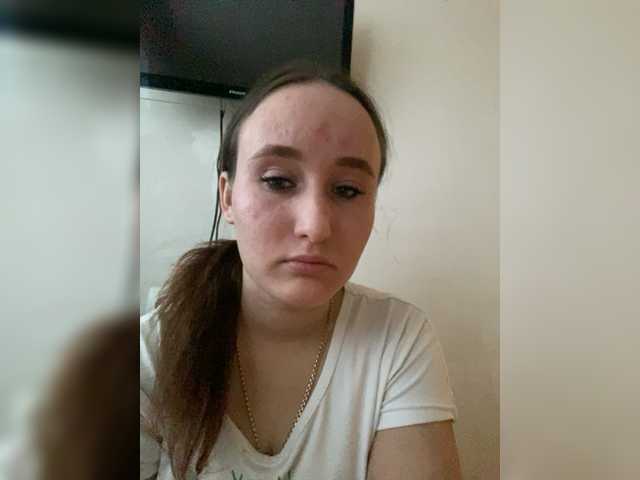 Anastesha87