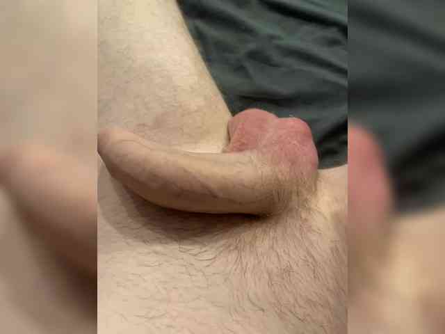 MRxx