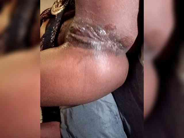 Nofacenocasea Nofacenocasea