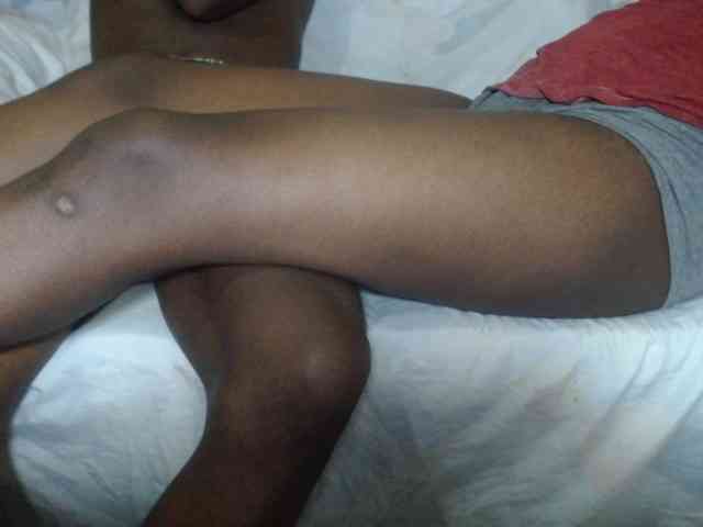 Hunterschoice webcam