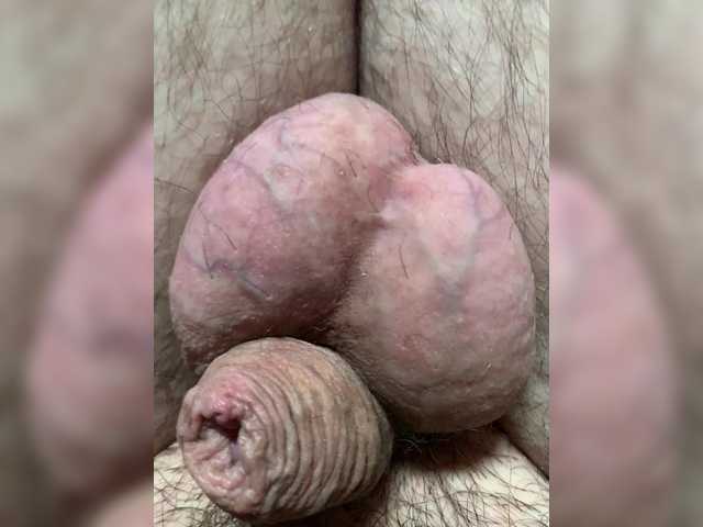 Ooooooops
