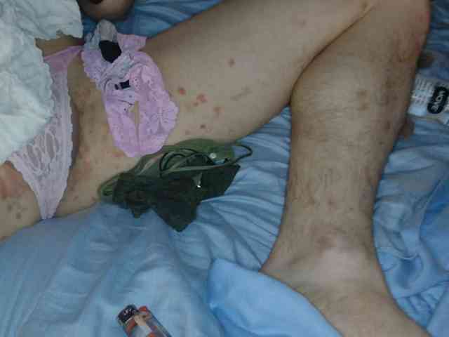 Stoneymtnhi Stoneymtnhi