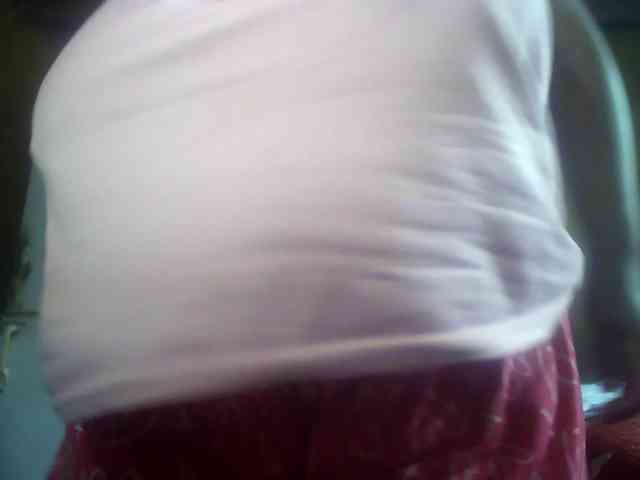 Melonboobs1 Melonboobs1