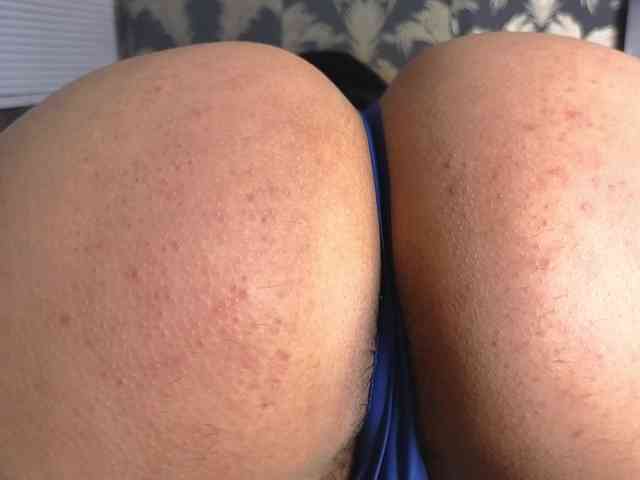 Tatiana-Blare Tatiana-Blare