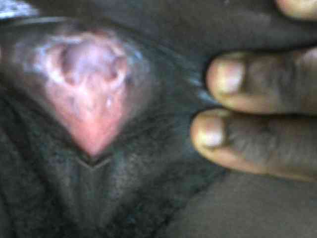 Pinkiec webcam