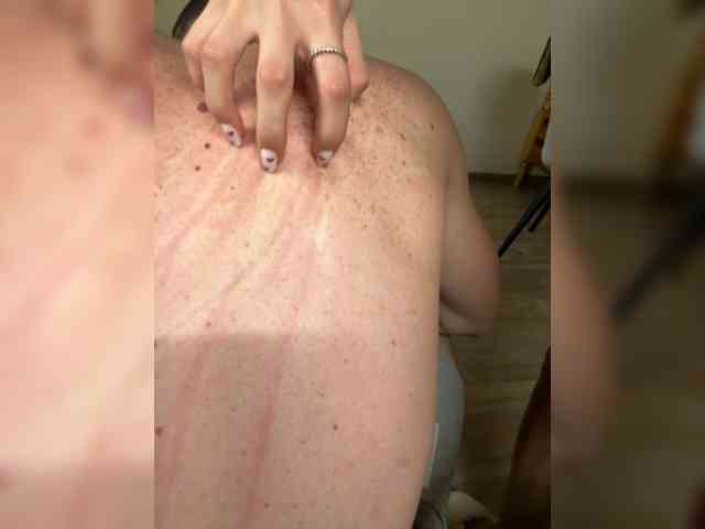 Bella-Oskar Bella-Oskar