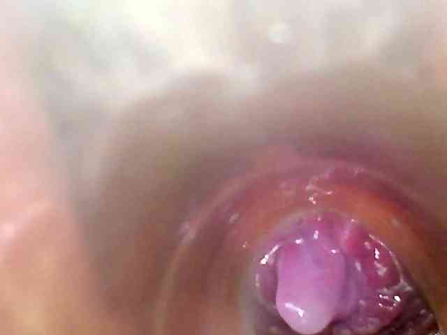 Shannon-kane Shannon-kane