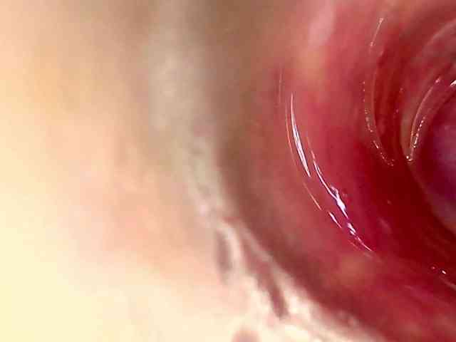 Shannon-kane Shannon-kane