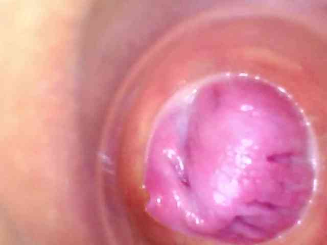 Shannon-kane Shannon-kane